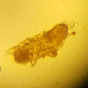 Tardigrade-văzute cu un microscop